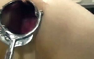 Bizarre xxl anal fisting and speculum gape